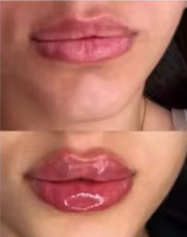 The Barb Lip Booster
